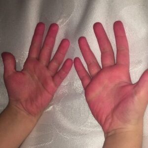 ethans stained hands