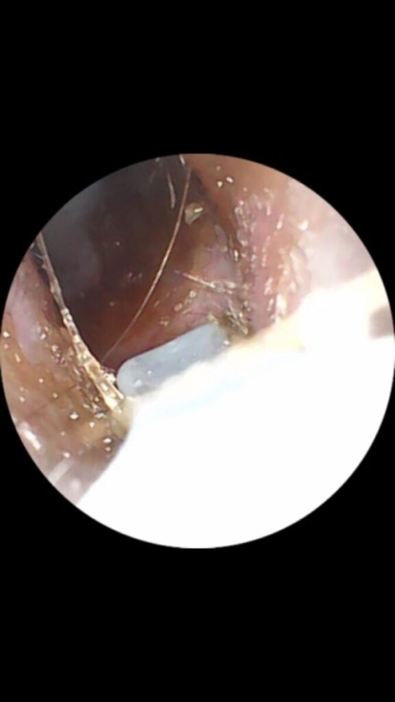 ear cleaner / ear wax image