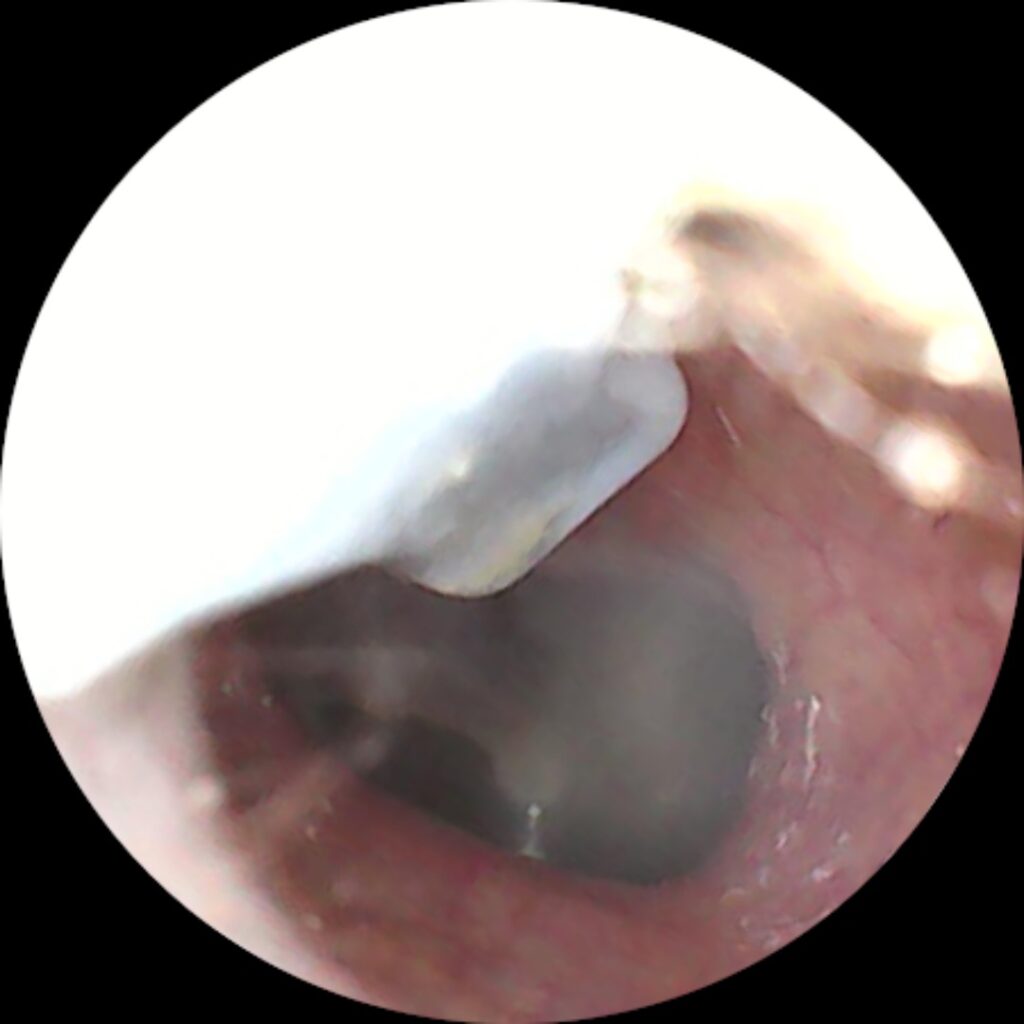 ear cleaner / ear wax image